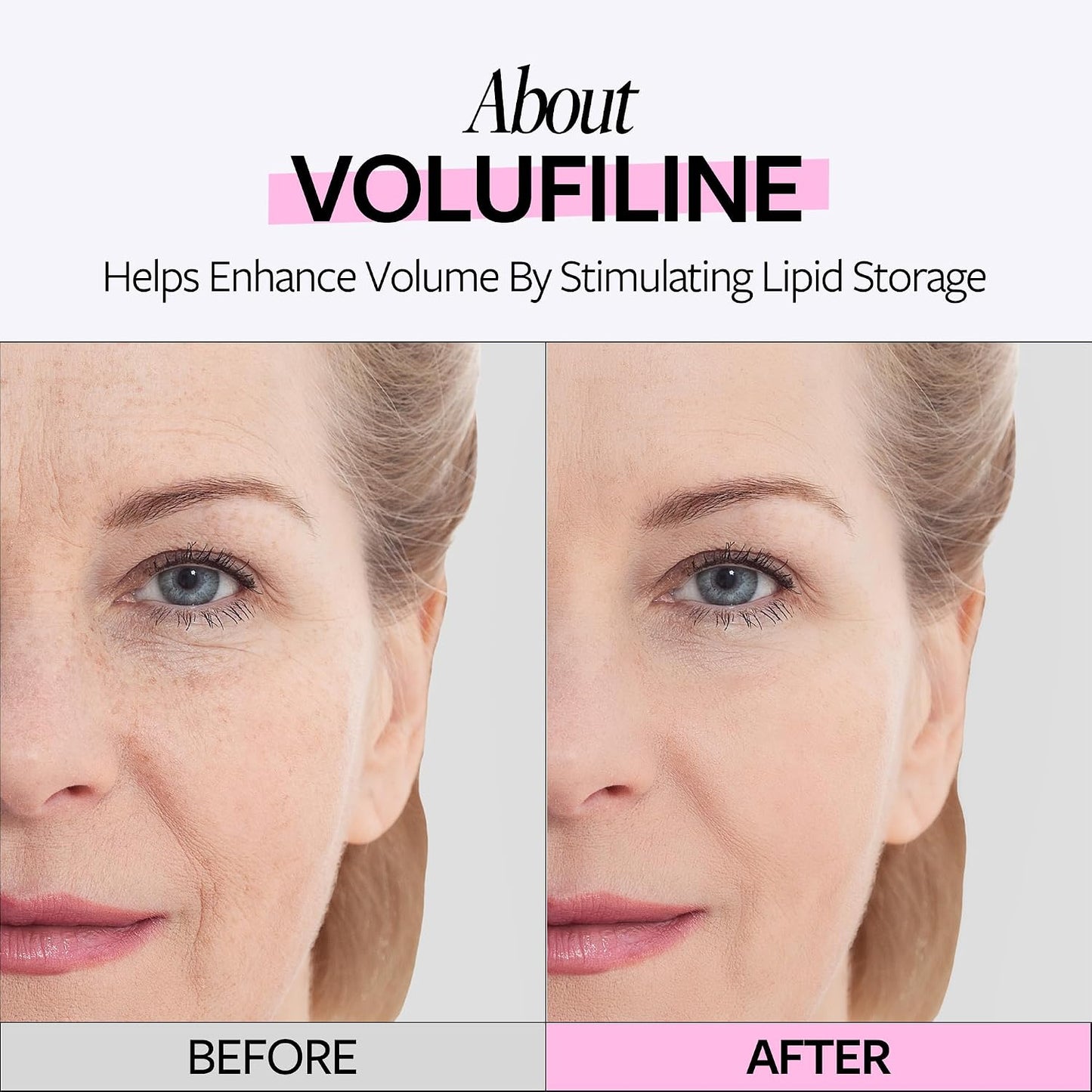 Volufiline 100% Plumping Ampoule