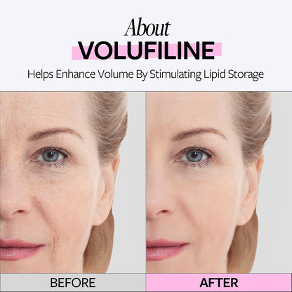 Volufiline 100% Plumping Ampoule
